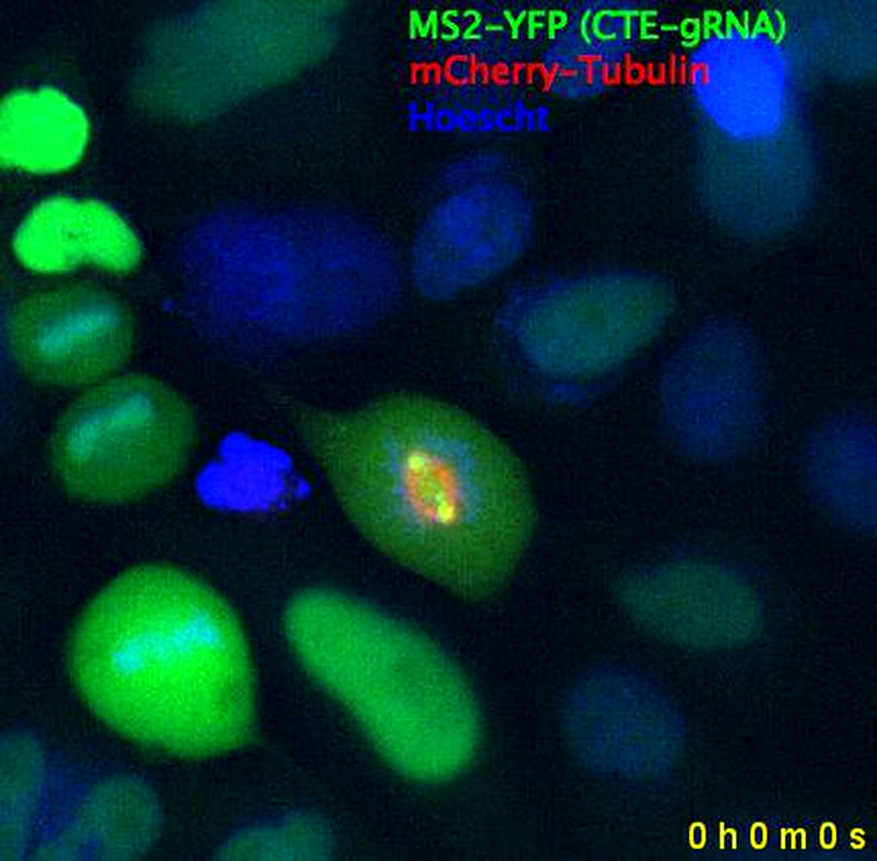 Fluorescence microscopy showing RNA, tubulin and DNA in a dividing cell